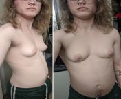 This is my chest almost 1 year on T. Do you guys think I have hope for creating a masculine- appearing chest with working out alone? I'm not worried about it looking as flat as possible, pecs/ moobs are acceptable. from flat chest sex doll porn